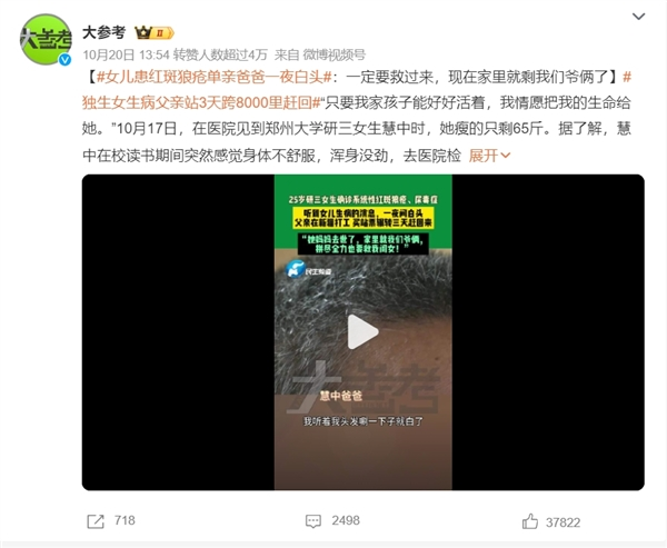 女儿患红斑狼疮致单亲父亲一夜白头：系统性红斑狼疮究竟能否治愈？